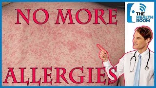 Top 10 HOME REMEDIES to Cure SKIN ALLERGIES NATURALLY [upl. by Enomrej]