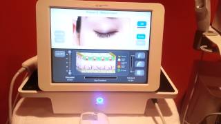 2010 Syneron eMatrix eTwo Sublative Radio Frequency Rejuvenation and Wrinkle Treatment For Sale [upl. by Ahsinav954]