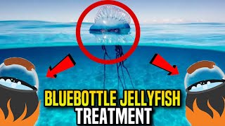 Bluebottle Jellyfish Stings What You Need to Know amp How to Treat Them [upl. by Winfrid]