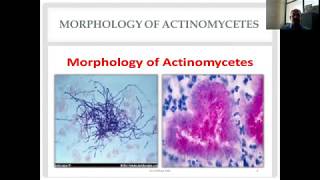 Actinomycetes and Nocardia Diverse Group of Gram Positive Bacilli [upl. by Miuqaoj]