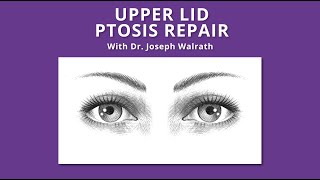 Upper Lid Ptosis Repair [upl. by Ardel779]