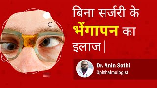 Squint Eye आँखों का भेंगापन Can Squint Eye can be treated without surgery  Dr Anin Sethi [upl. by Yelrehs484]