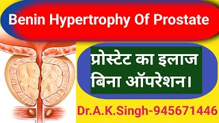 Why Prostate Gland Gets EnlargedProstate Problemप्रोस्टेट क्यों बढ़ जाता हैं [upl. by Maddox]