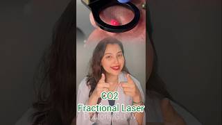 Is CO2 Fractional Laser for you🤔⚡ aesthetic skincare glassskin openpores smoothskin [upl. by Camey524]