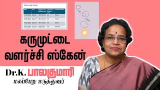 Follicular study  கரு முட்டை வளர்ச்சி ஸ்கேன் [upl. by Lesak]