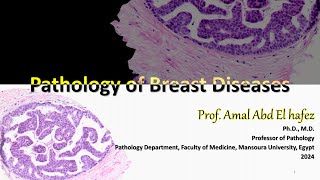 Breast Disease Pathology شرح محاضرة [upl. by Ayerf]