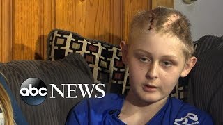 Miraculous recovery for 13yearold declared brain dead [upl. by Nnaylrebmik]