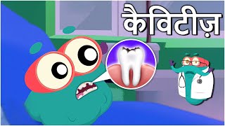 कैविटीज़  दांतों में कीड़े  Cavities In Hindi  DrBinocs Show  Educational Videos For Kids [upl. by Eelirrem286]