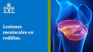 Webinar Lesiones meniscales en rodillas [upl. by Marcel]