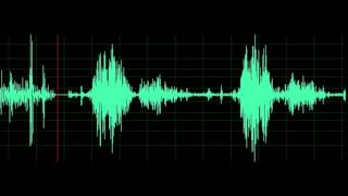 Normal Breath Sound [upl. by Missy664]