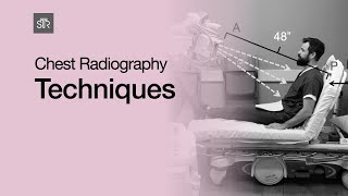 Chest Radiography Techniques [upl. by Aroel59]