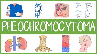 Pheochromocytoma in 3 Minutes [upl. by Engedi637]