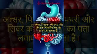 पेट का अल्ट्रासाउंड क्यों आवश्यक है  Abdominal Ultrasound  Best Gastro Hospital in Kanpur [upl. by Morgan357]