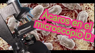 Cómo se ven los ÁCAROS a nivel MICROSCÓPICO [upl. by Winikka]