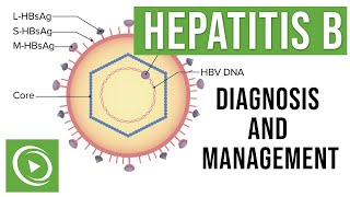 Hepatitis B Overview Clinical Presentation Diagnosis and Management  Lecturio [upl. by Divadleahcim705]