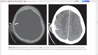 RADIOLOGY EXAM CASES [upl. by Kenimod]