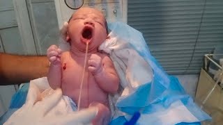 New born baby inhale meconium and amniotic fluid take action remove all by suction clean baby 🖤 [upl. by Jamey]