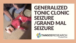 Generalized Tonic Clonic Seizure  Grand Mal Seizure [upl. by Isador]