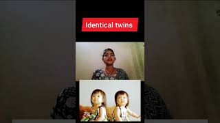 monochorionoc Diamniotic twins pregnancy kya hoti hai identical twins pregnancy dizygotic twins preg [upl. by Minica875]