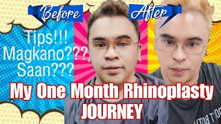 My One Month Rhinoplasty Journey Tips Before amp After Procedure MagkanO ang Gastos sa Rhinoplasty [upl. by Corena]