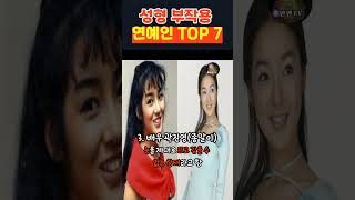 성형 부작용 연예인 TOP 7 [upl. by Warchaw]