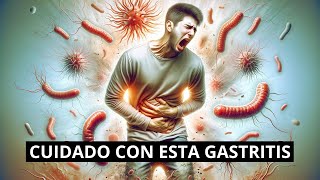 Gastritis Eritematosa Antral TRATAMIENTO 🔥 Síntomas y Causas de la Gastritis Eritematosa Antral [upl. by Zeralda873]