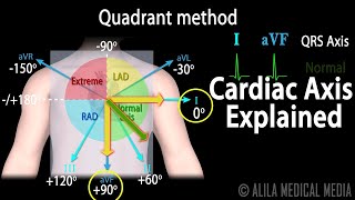 Cardiac Axis Interpretation Animation [upl. by Yoreel]