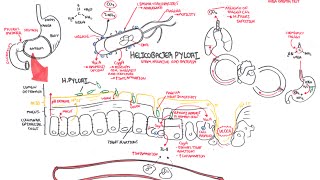 Microbiology  Helicobacter Pylori Ulcer [upl. by Shiau]