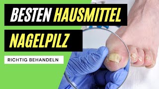 ✅ Nagelpilz behandeln  Die BESTEN Hausmittel zum entfernen [upl. by Esinyt]