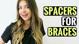 GETTING SPACERS FOR BRACES  WHAT ARE SPACERS PAIN HOW LONG [upl. by Ydnerb]