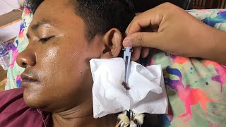 Asmr ear cleaning waxing cleaning ear asmr removal [upl. by Alyaj]