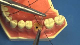 Surgical Technique  Figure of Eight Close Vertical Dental amp Medical Suturing by Stuart OrtonJones [upl. by Leizahaj]