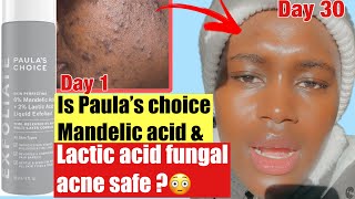 ✨HOW TO PROPERLY USE PAULA’S CHOICE 6 Mandelic Acid  2 Lactic Acid Liquid Exfoliant✨ [upl. by Aemat]