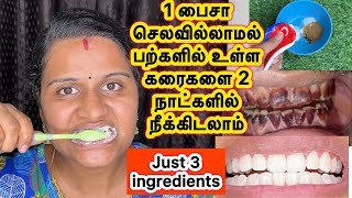 Teeth whitening at homeWhitening teeth home RemediesHow to whiten teethbhuvana pandi lifestyle [upl. by Aicile]