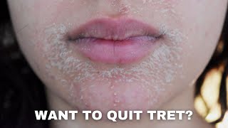 WATCH THIS BEFORE QUITTING RETINA  PURGING DRYNESS ACNE AND ANTIAGING [upl. by Kajdan]