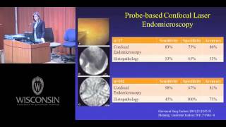 Advances in Diagnosis amp Treatment of Hilar Cholangiocarcinoma [upl. by Oilcareh]