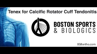 Tenex for Rotator Cuff Calcific Tendonitis Shoulder Calcifications [upl. by Sherourd]