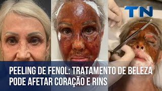 Peeling de fenol tratamento de beleza pode afetar coração e rins [upl. by Alad]