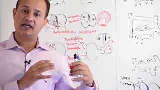 Atrial Development  Embryology [upl. by Seuqram]