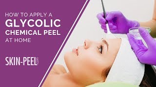 How to Apply Glycolic Chemical Face Peel At Home [upl. by Rovner]