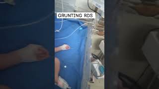 grunting rds neonate babygrunt ytviral shortsfeed nursingofficer hospitallife grunt nurses [upl. by Lepper]