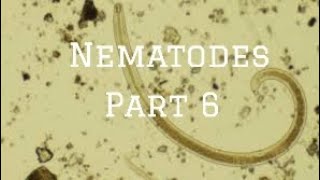 Intestinal Nematodes Strongyloides nematode microbiology [upl. by Sternberg]