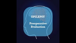 Neurosurgery Basics Lecture  Epilepsy  Preoperative evaluation [upl. by Cirdet]