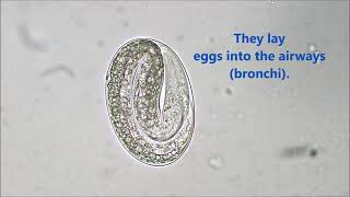 Dictyocaulus viviparus egg Bovine Lungworm quotHoosequot [upl. by Nerej]