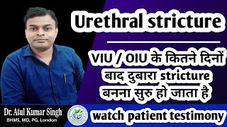 The Journey of Urethral Strictures From Diagnosis to VIU OIU to Recovery and role of homeopathy [upl. by Iives]