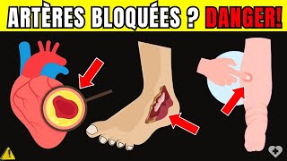 🛑Alerte Cardiaque 7 Signes dartères Bloquées Dans les Jambes et Les Pieds qui Mettent vie Danger [upl. by Ominoreg973]