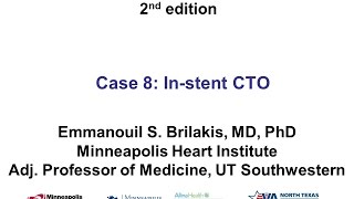 Case 8 Manual of CTO Interventions  Investment for ISR CTO [upl. by Suryt]