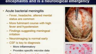 clinical approach to encephalitis [upl. by Corwun]