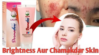 Dermadew Caloe Lotion hindi Review Iska Kam Kya Hai Side Effects Uses  benefits digitalmedilife [upl. by Assennej934]