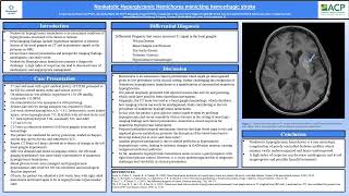 Nonketotic Hyperglycemic HemichoreaACP Poster Presentation 2024 [upl. by Oakes]